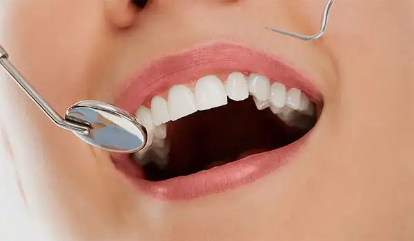 Ordinacija dentalne medicine Petra Jurić, dr.med.dent. - Zubar Zadar